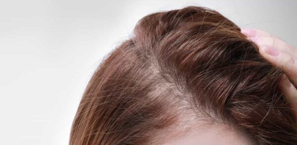 Shampoo Anticaída Fórmula 7 Professional - 500 ML. 2 a 3 Meses - Imagen 8